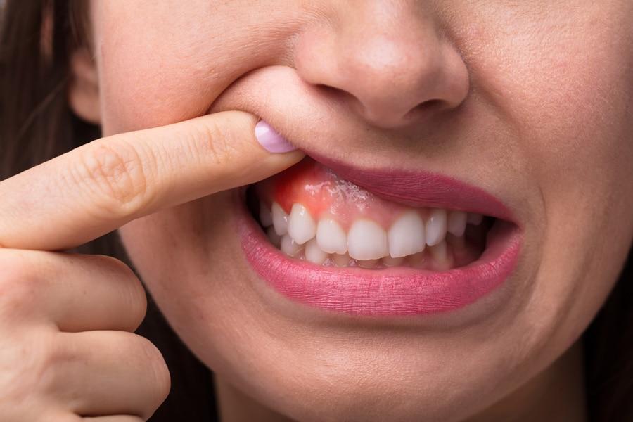 Dor na Gengiva: Sinais de Alerta Que Você Não Deve Ignorar — Dor na Gengiva e Doenças Periodontais