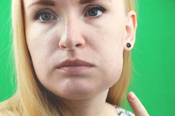 Dente Infeccionado: Sinais de Alerta que Você Não Deve Ignorar — Cuide da Sua Boca com Quem Entende do Assunto