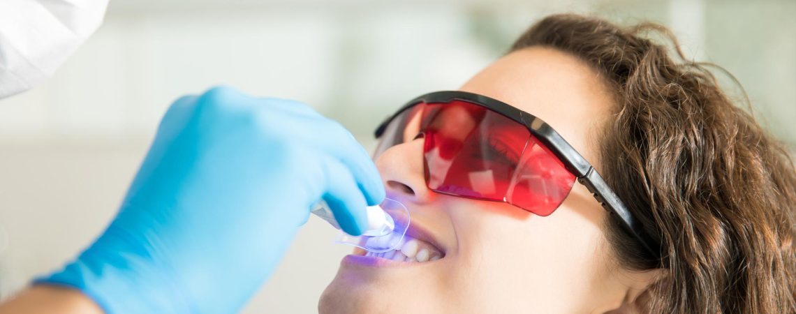 closeup-de-jovem-tendo-seus-dentes-clareados-com-luz-ultravioleta-em-uma-clinica-odontologica