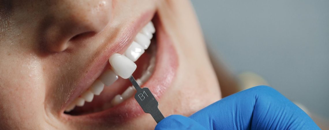 dentist-whiting-teeth