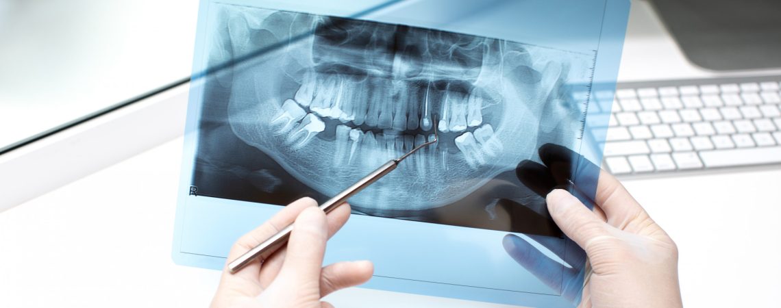 dentista-analisa-foto-de-raio-x