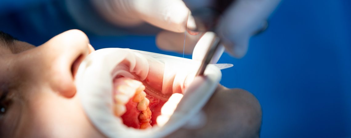 paciente-na-clinica-odontologica-durante-a-operacao (1)